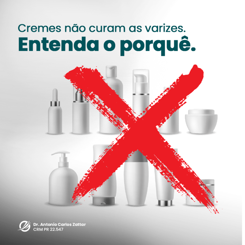 Por que cremes não curam as varizes?